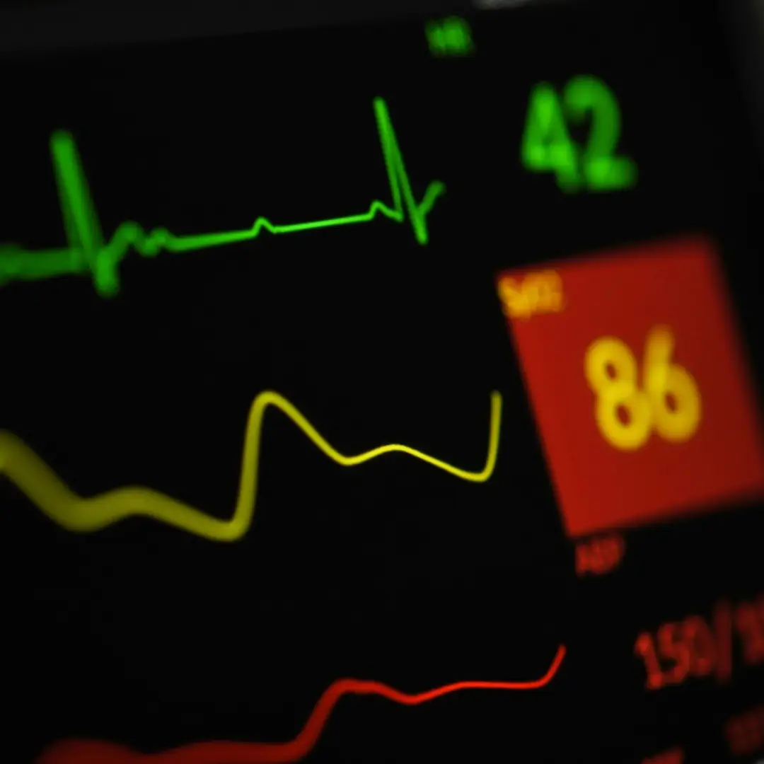 Ecocardiogramma color Doppler